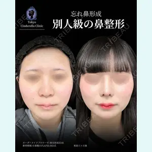 東京シンデレラ美容外科 新宿院 吉原 伯医師の症例