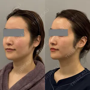 ARIEL.BUST.CLINIC 石塚 紀行医師の症例