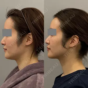 ARIEL.BUST.CLINIC 石塚 紀行医師の症例