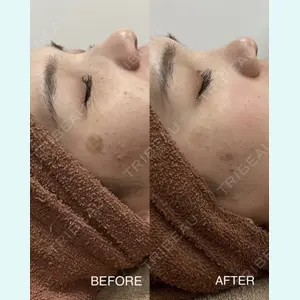 REDLINE CLINIC 出嶋 哲也医師の症例