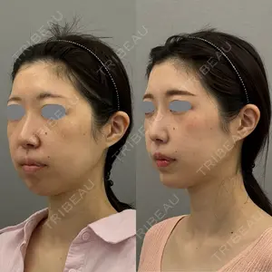 ARIEL.BUST.CLINIC 石塚 紀行医師の症例