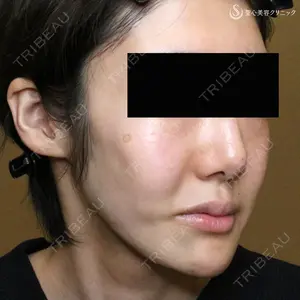 聖心美容クリニック 札幌院 前多 一彦医師の症例