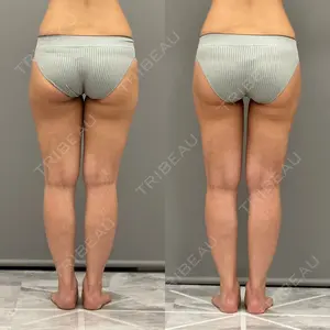 ARIEL.BUST.CLINIC 石塚 紀行医師の症例