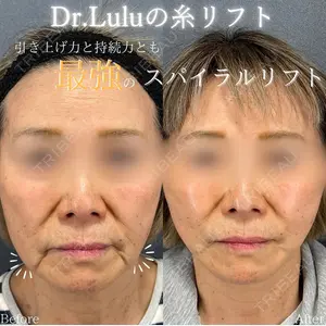 症例