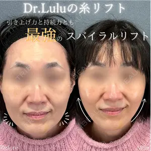 症例