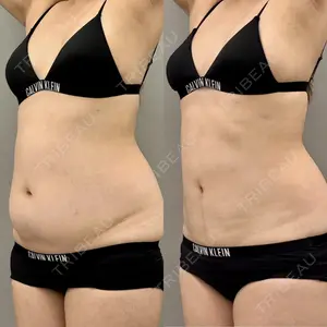ARIEL.BUST.CLINIC 石塚 紀行医師の症例