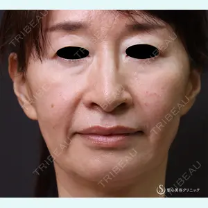 聖心美容クリニック 横浜院 佐々木 直美医師の症例