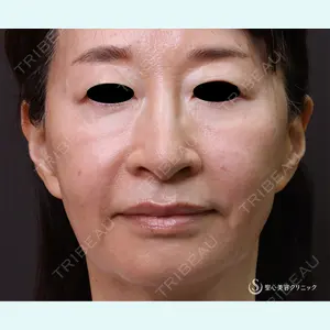 聖心美容クリニック 横浜院 佐々木 直美医師の症例