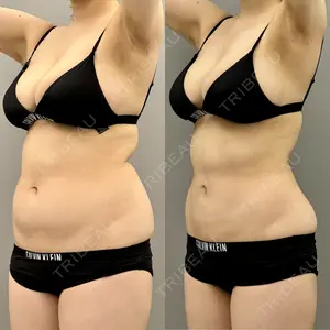 ARIEL.BUST.CLINIC 石塚 紀行医師の症例