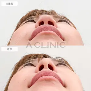 症例
