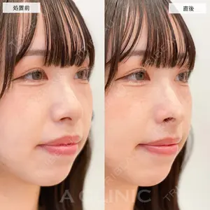 A CLINIC（エークリニック） 大阪院 木家 佑理子医師の症例