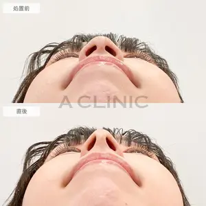 A CLINIC（エークリニック） 大阪院 木家 佑理子医師の症例