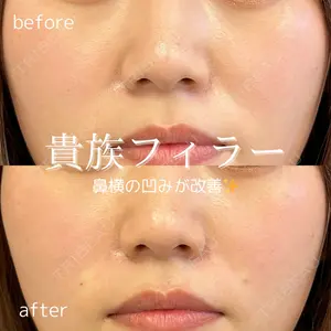 ルラ美容クリニック 仙台院 橋本 英樹医師の症例