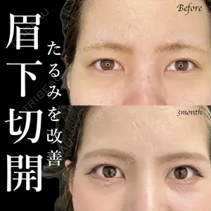 症例