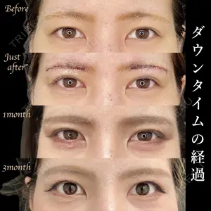 症例