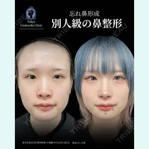 東京シンデレラ美容外科 新宿院 吉原 伯医師の症例