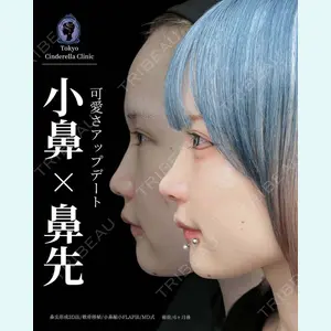 東京シンデレラ美容外科 新宿院 吉原 伯医師の症例
