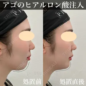 症例