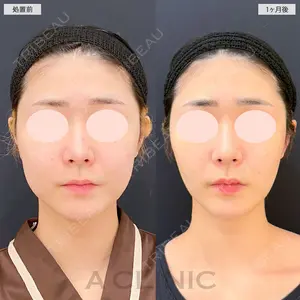 A CLINIC（エークリニック） 大阪院 木家 佑理子医師の症例