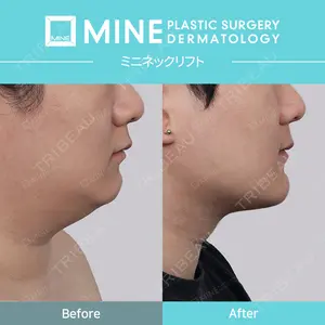 マイン美容外科 イ・ソンウク医師の症例