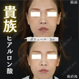 症例