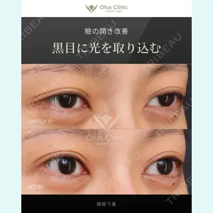 Otus Clinic 【オータスクリニック】 中 徳太郎医師の症例