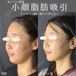 ルラ美容クリニック 仙台院の症例
