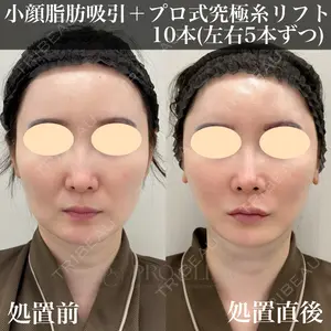 症例