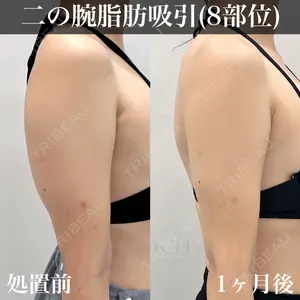 症例