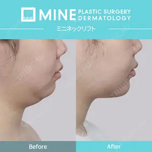マイン美容外科 イ・ソンウク医師の症例
