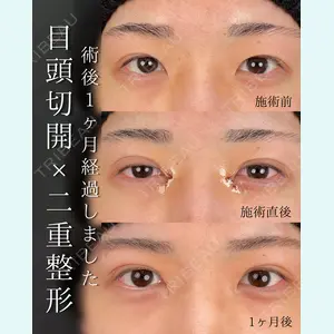 症例