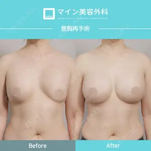症例