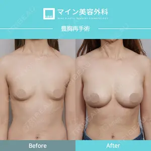 症例