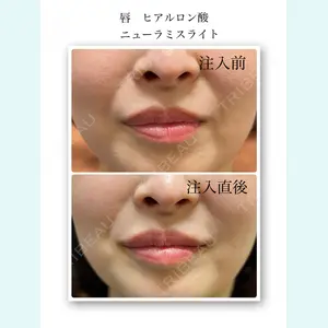 おおたかの森ビューティークリニックの症例