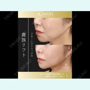 症例