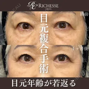 症例