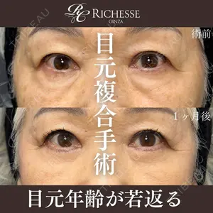 症例