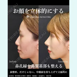 シンデレラ＆ダヴィンチクリニック 宮田 洋佑医師の症例