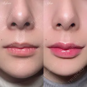 R Beauty CLINIC 銀座院 村山史朗医師の症例