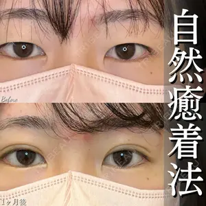 ルラ美容クリニック 大宮院 / ルラスキンクリニック 大宮院 右京 大季医師の症例
