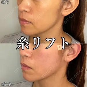 形成外科と美容外科のクリニック池袋 春日 航医師の症例