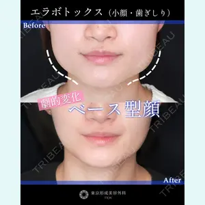 症例
