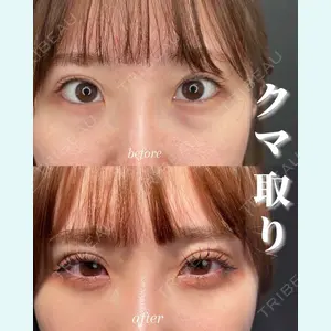 症例