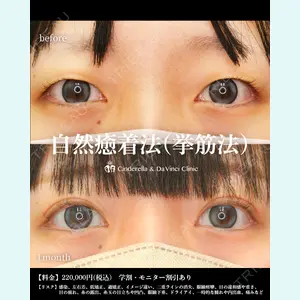 シンデレラ＆ダヴィンチクリニック 宮田 洋佑医師の症例