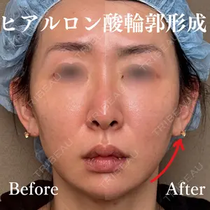 症例