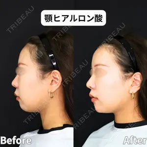 症例