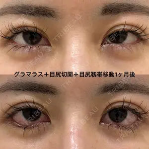 エターナル美容クリニック 久門田 詳医師の症例