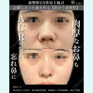 グローバルビューティークリニック 銀座院 理事長　杉崎　裕斗医師の症例