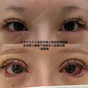 エターナル美容クリニック 久門田 詳医師の症例