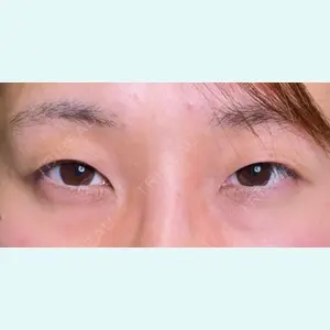 症例